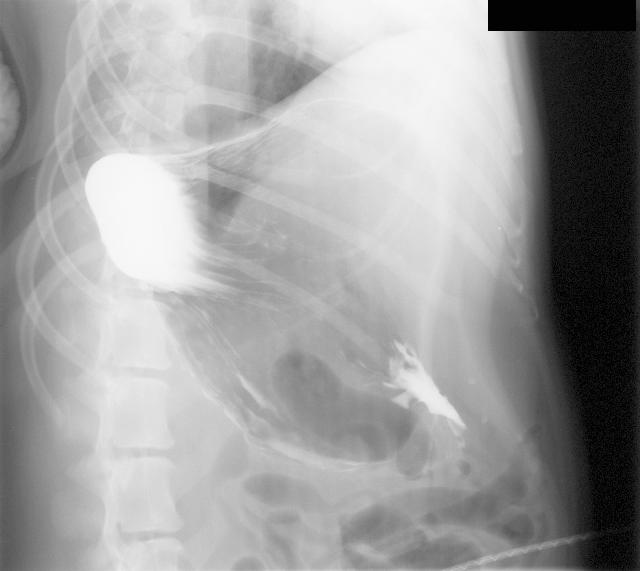 Normal Gastrogram Dog worka/vanilla-js-wheel-zoom